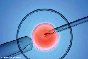 林靜遠